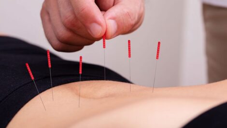 medicina-tradicional-china-y-acupuntura