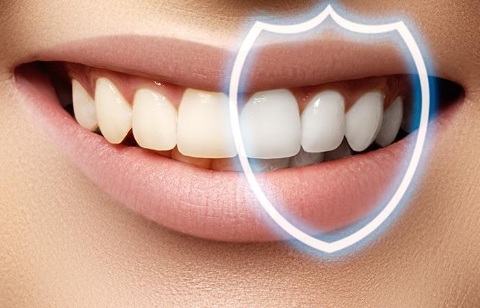 dientes-blancos-